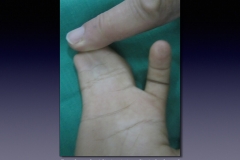 Before-After.013