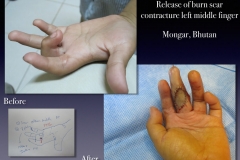 Before-After.021