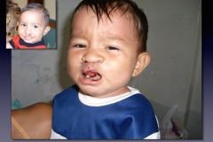 Before-After.043