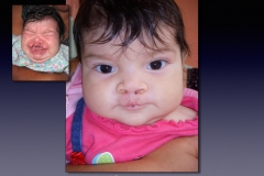 Before-After.055