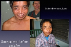 Before-After.075