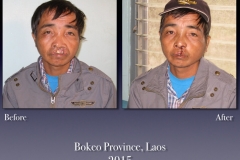 Before-After.077