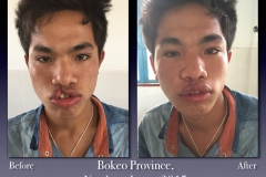 Before-After.079