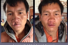 Before-After.082