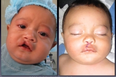 Before-After.089