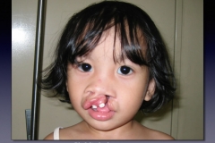 Before-After.090