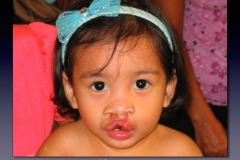 Before-After.091