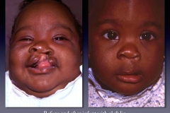 Before-After.094