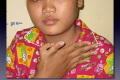 Cambodia.200