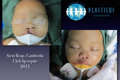 Cambodia.208