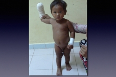 Cambodia.217