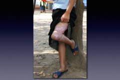 Laos-1-022