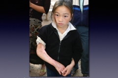 Laos-1-034