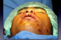 Laos-2-019