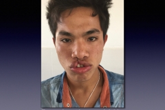 Laos-2-046