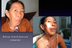 Laos-2-051