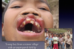 Laos-2-052