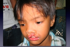 Philippines.021