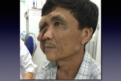 Vietnam.164