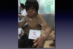 Our-Patients.050.1