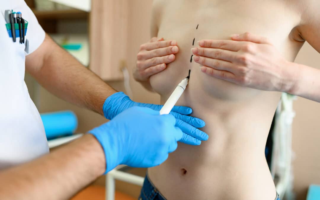 male doctor drawing on woman's chest in prep for surgery