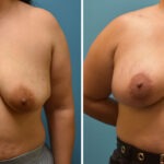 Thumbnail of