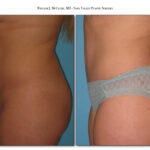 Thumbnail of