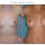 Thumbnail of