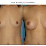Thumbnail of