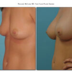 Thumbnail of