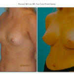 Thumbnail of