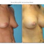 Thumbnail of