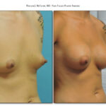 Thumbnail of