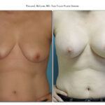 Thumbnail of