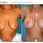 Thumbnail of
