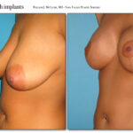 Thumbnail of