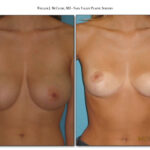 Thumbnail of