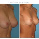 Thumbnail of