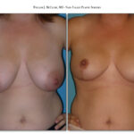 Thumbnail of