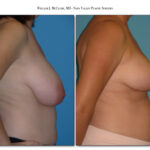 Thumbnail of