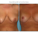 Thumbnail of