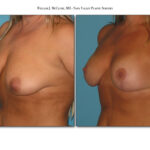 Thumbnail of