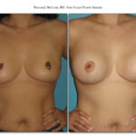 Thumbnail of