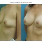 Thumbnail of