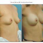 Thumbnail of