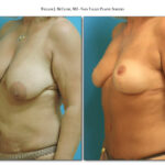 Thumbnail of