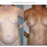 Thumbnail of
