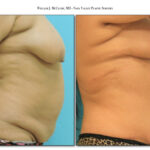 Thumbnail of
