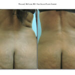 Thumbnail of