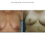 Thumbnail of